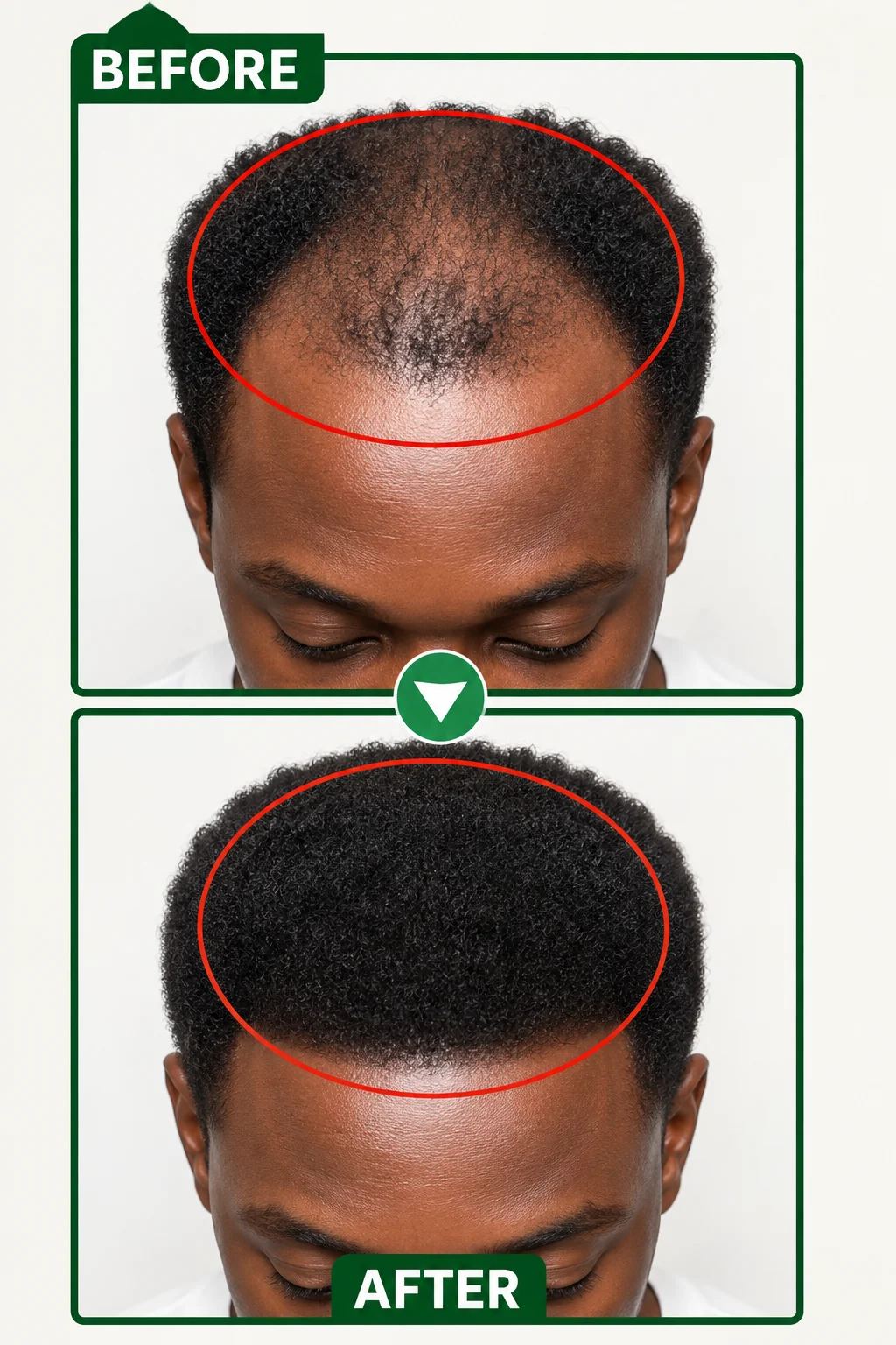 Before Fulani Hair Gro