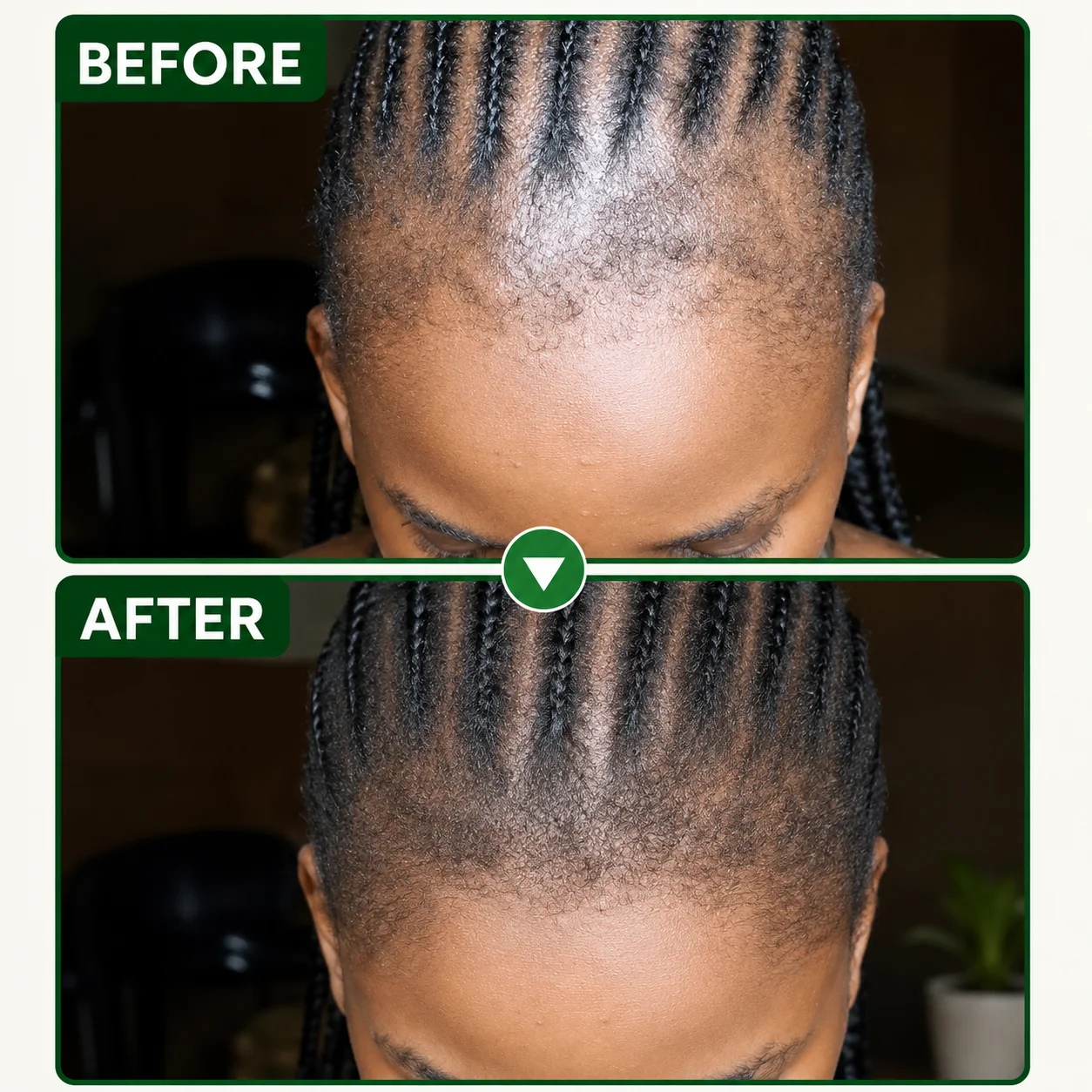 After Fulani Hair Gro