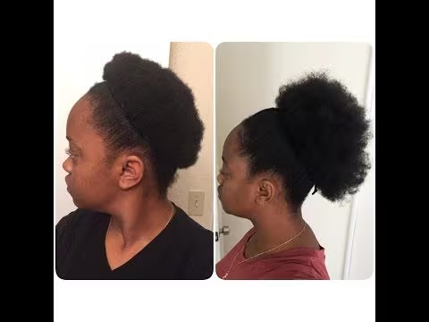 Hair growth results