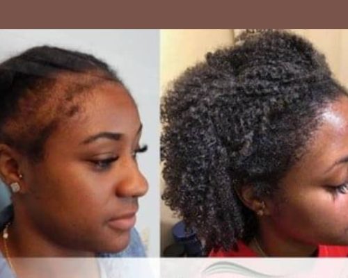 https://fulanihairsecrets.com/wp-content/uploads/2024/10/WhatsApp-Image-2024-09-26-at-15.05.24.jpeg